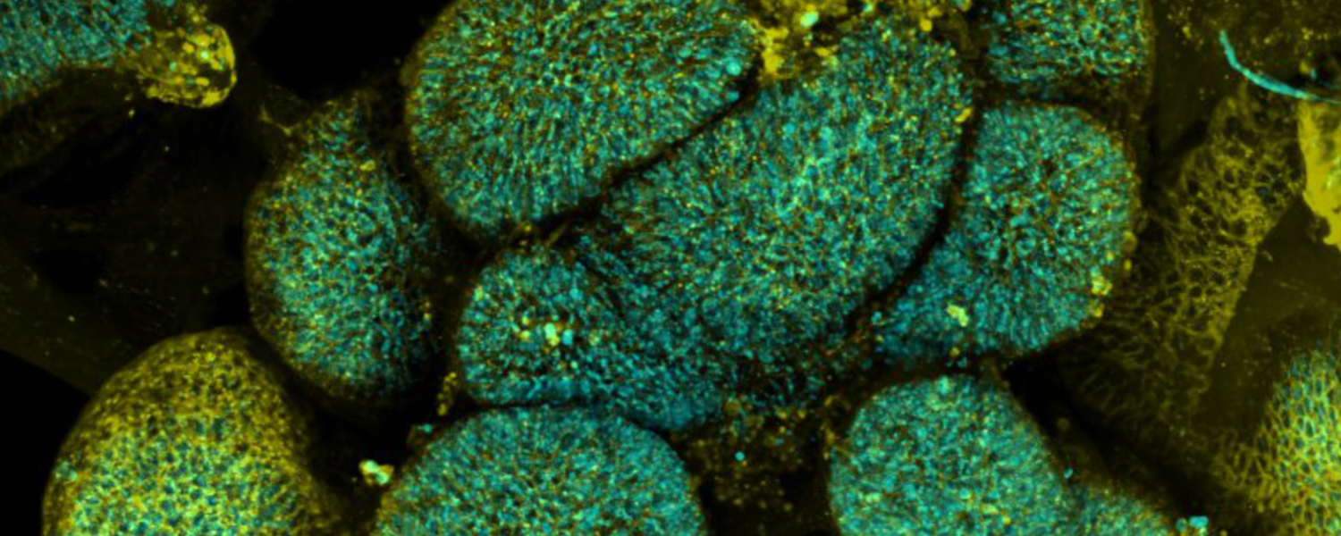 Immunofluorescence image of intestinal organoids