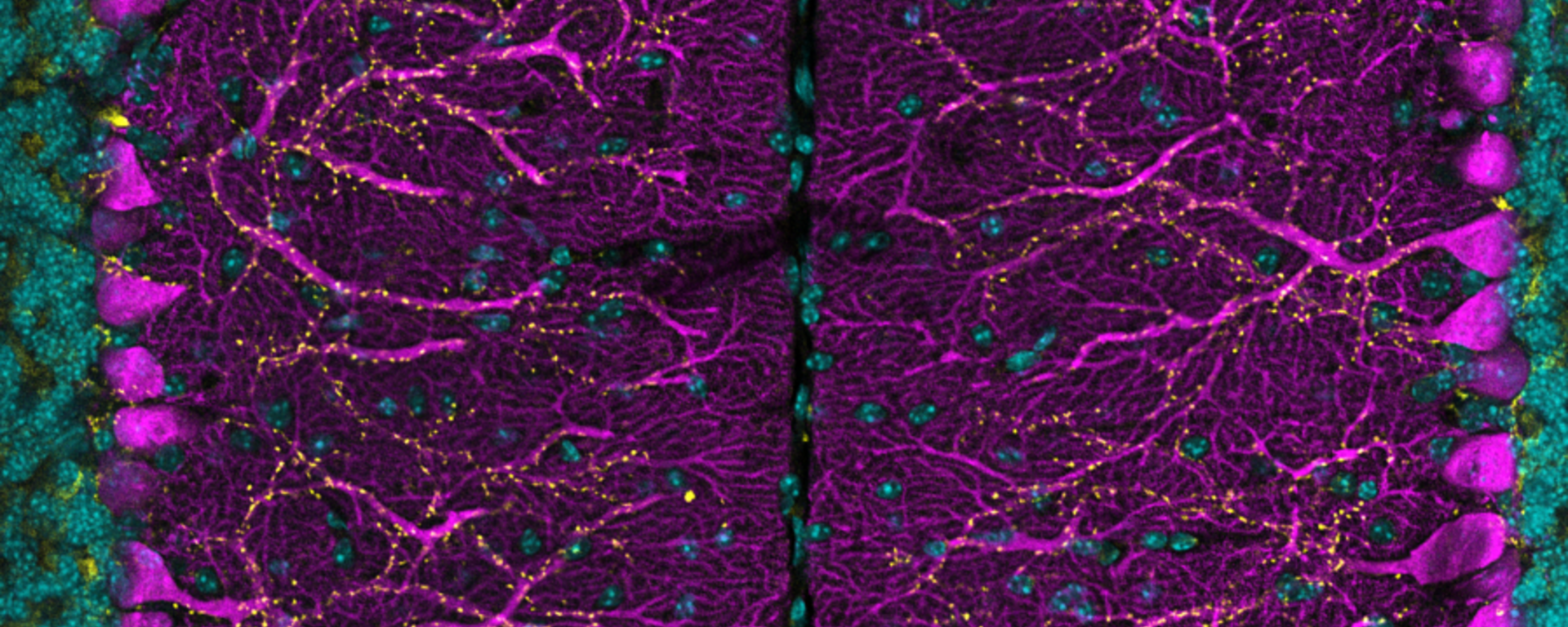 magenta, cyan and yellow cells and pre-synapses