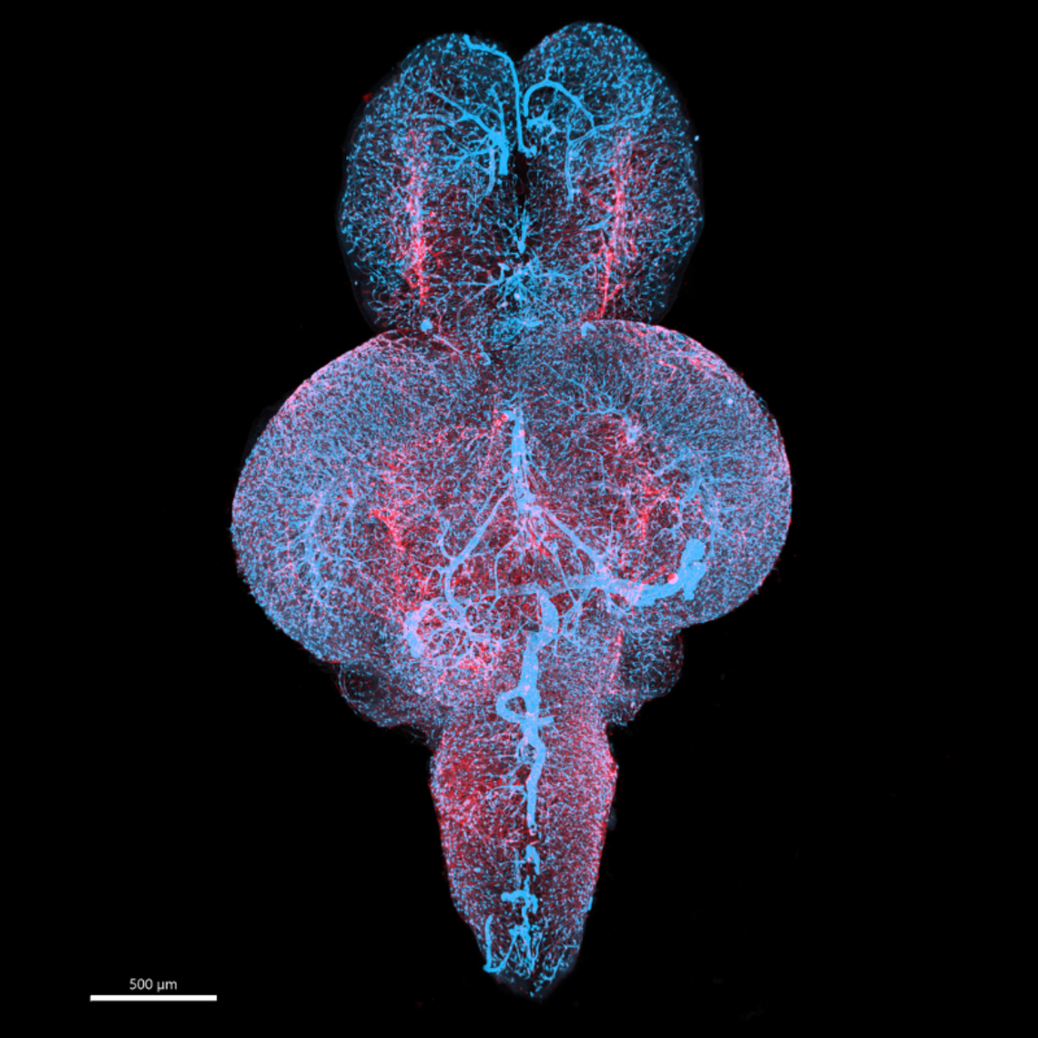 Zebrafish brain microscopy image. Coloured light blue and red.