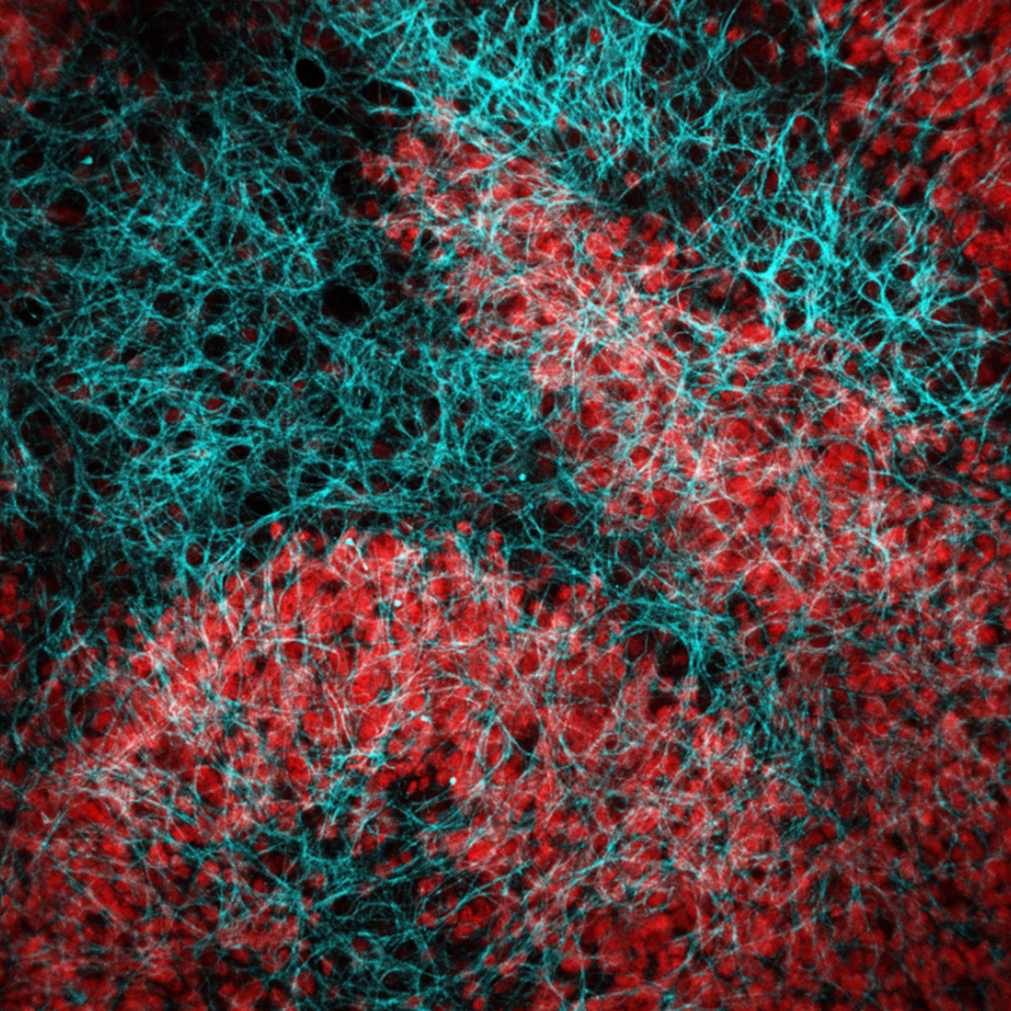 Microscope image of cerebellum