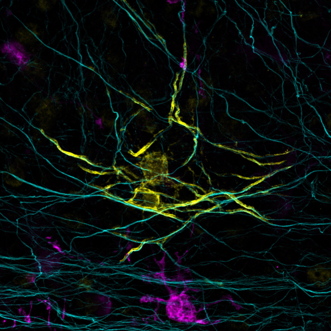 Image of neurons and other cells in the brain.