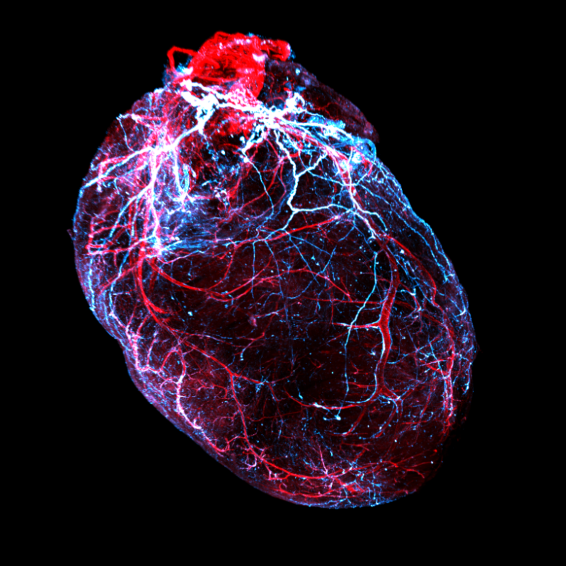 Image of a cleared mouse heart.