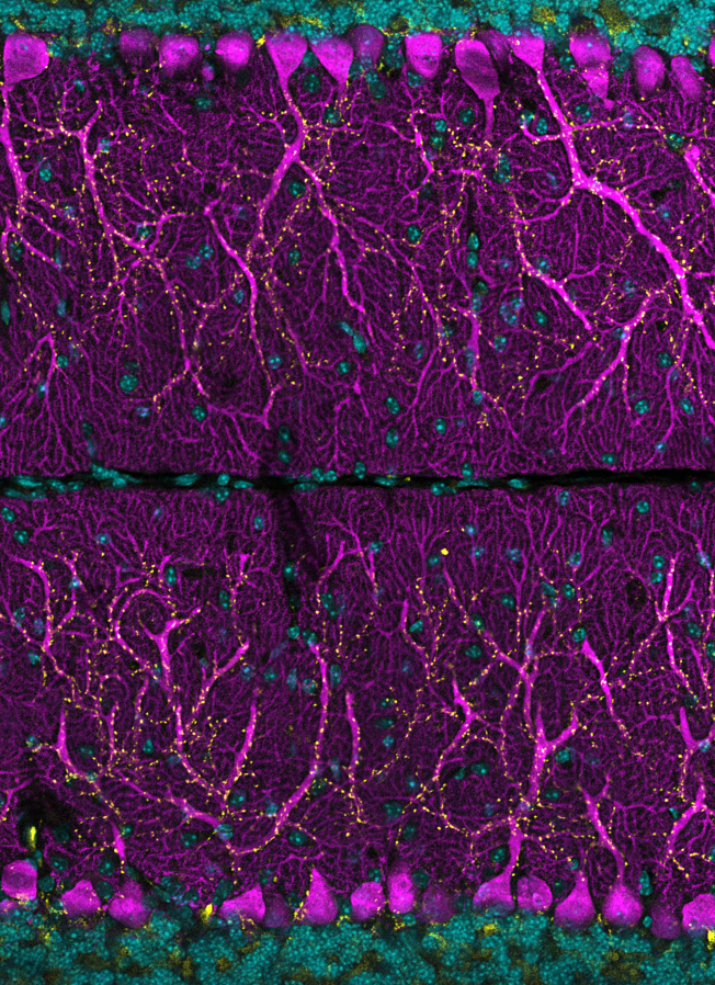 Image of cells, magenta, yellow, cyan