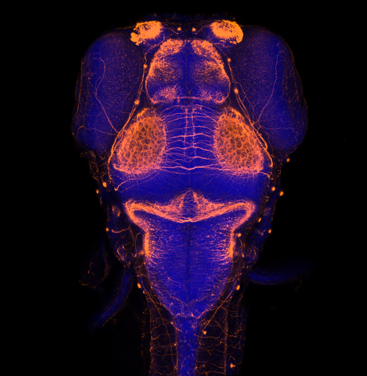 Image of mouse brain. Blue and orange coloured 