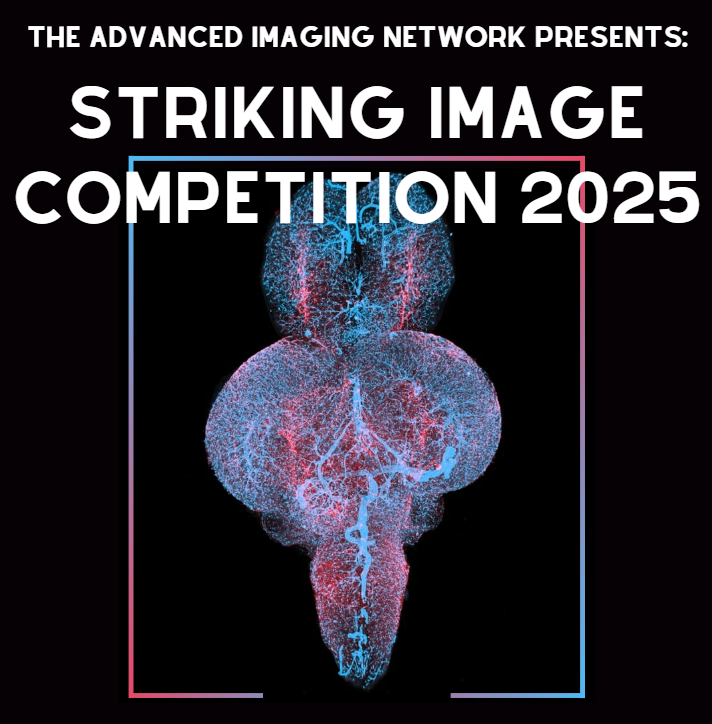 Black background with microscopy image of zebrafish brain. "The Advanced Imaging Network Presents: Striking Image Competition 2025" overlayed in white.