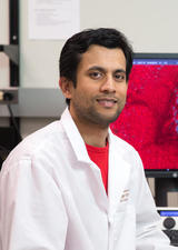 Researcher looks for ways to slow the growth of liver metastasis
